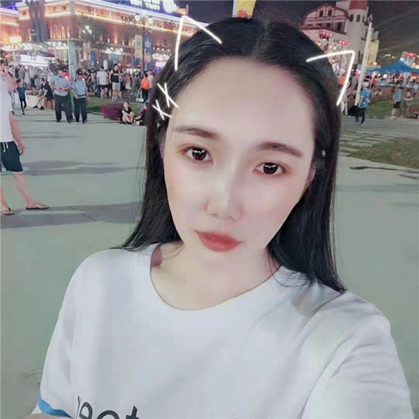 青岛艾菲刘翔脂肪填充怎么样?价格案例
