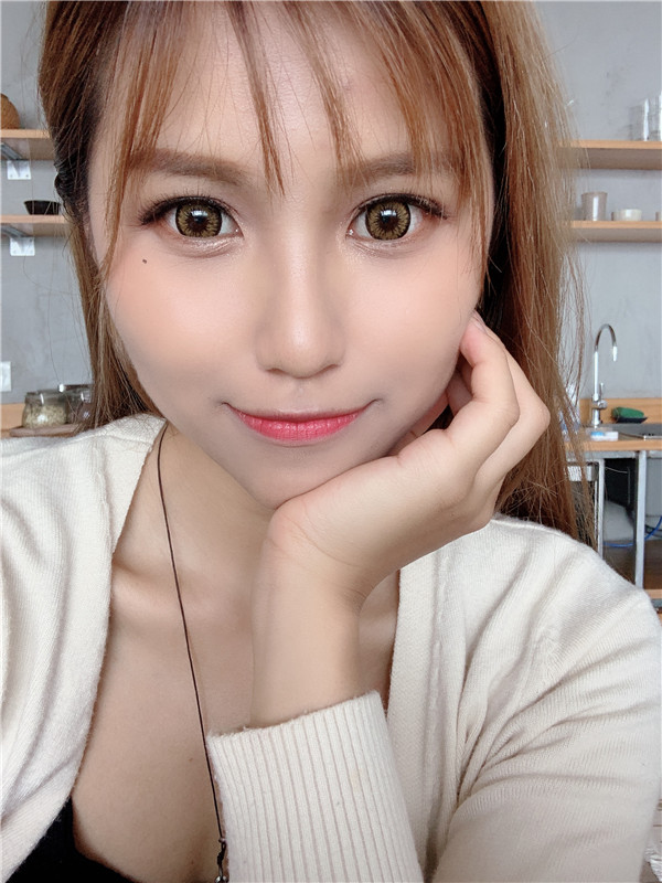上海迪蔻常双明脂肪填充怎么样?价格案例