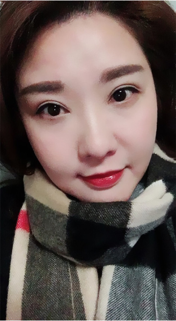 佛山美莱张春光眼部整形怎么样?价格案例