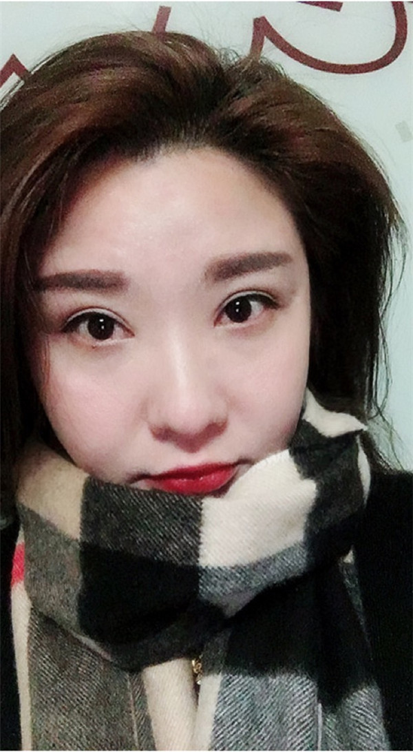 佛山美莱张春光眼部整形怎么样?价格案例