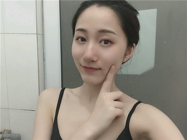 重庆好美李曾显双眼皮怎么样?价格案例