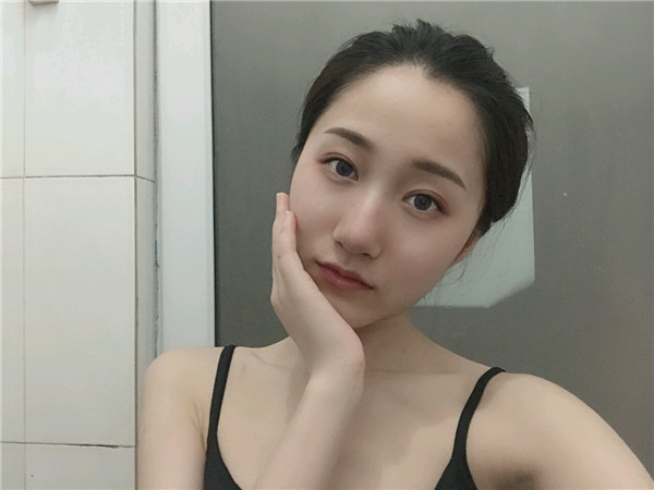 重庆好美李曾显双眼皮怎么样?价格案例