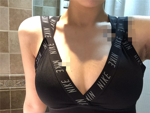 哈尔滨韩美于兆松隆胸怎么样?价格案例