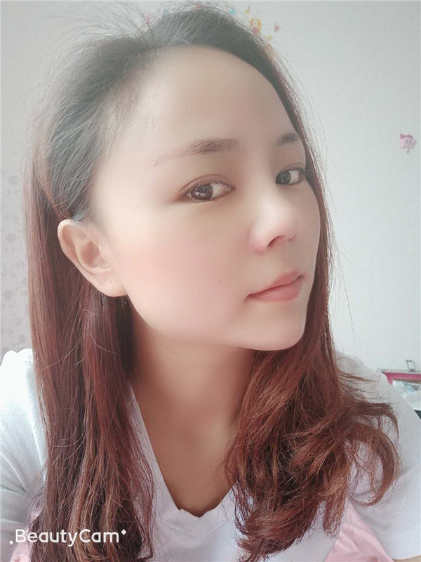 云南华美美莱洪晓娅隆鼻怎么样?价格案例
