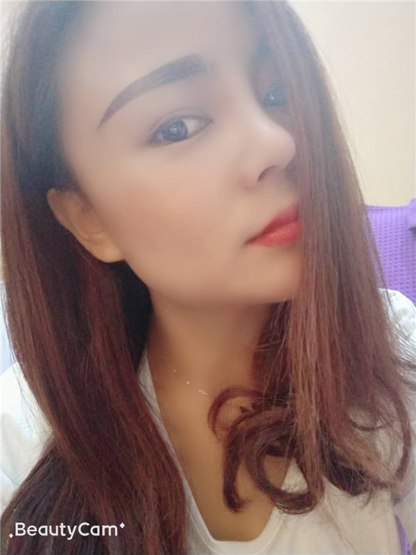 云南华美美莱洪晓娅隆鼻怎么样?价格案例