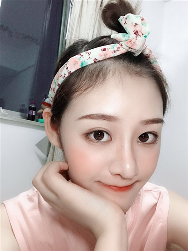 长沙南湖整形龙建隆鼻怎么样?价格案例