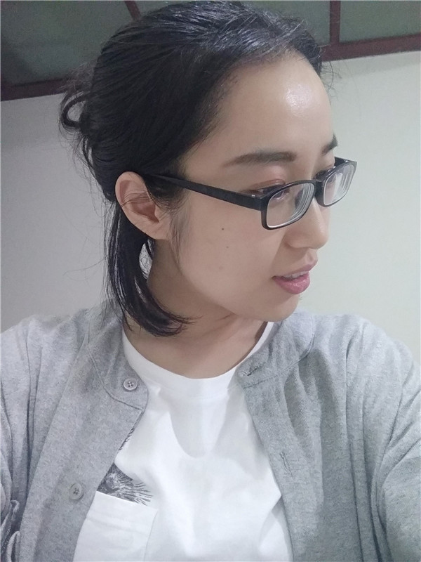 成都恒博兰京植发怎么样?价格案例