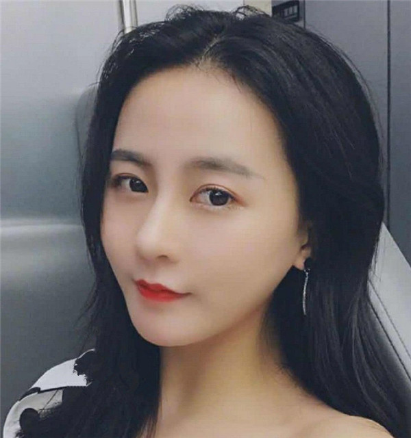 南京缪斯女神范家鑫隆鼻怎么样?价格案例