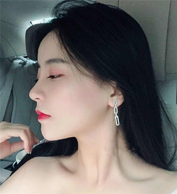 南京缪斯女神范家鑫隆鼻怎么样?价格案例