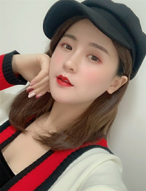 南京缪斯女神范家鑫隆鼻怎么样?价格案例