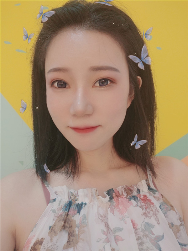 芜湖伊莱美徐世龙眼部整形怎么样?价格案例