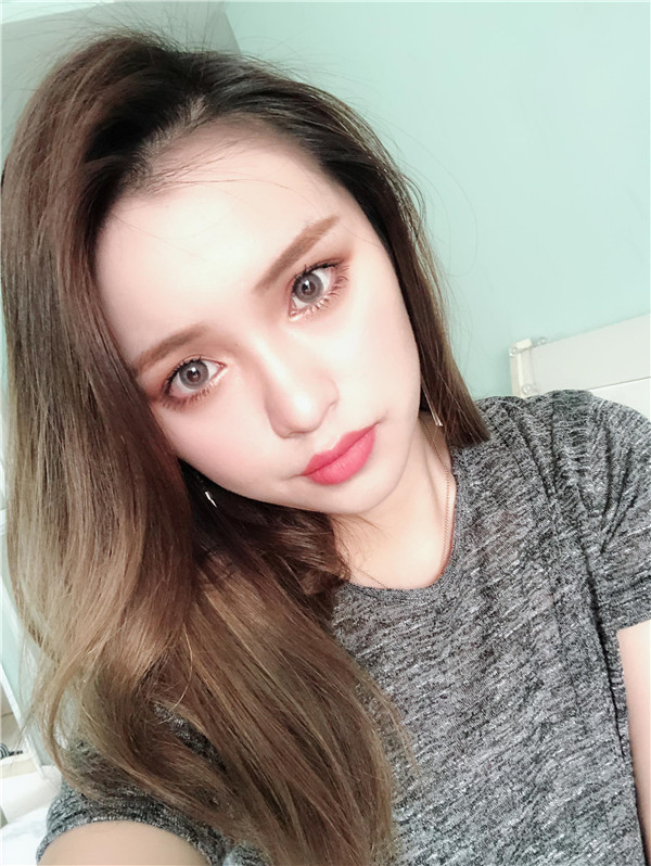 南京美贝尔黄名斗鼻部手术怎么样?价格案例