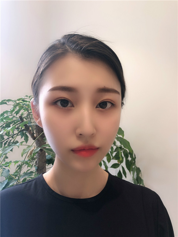南京美贝尔陈刚隆鼻怎么样?价格案例