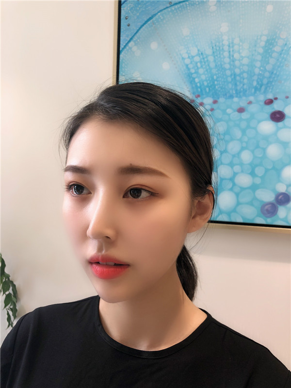 南京美贝尔陈刚隆鼻怎么样?价格案例