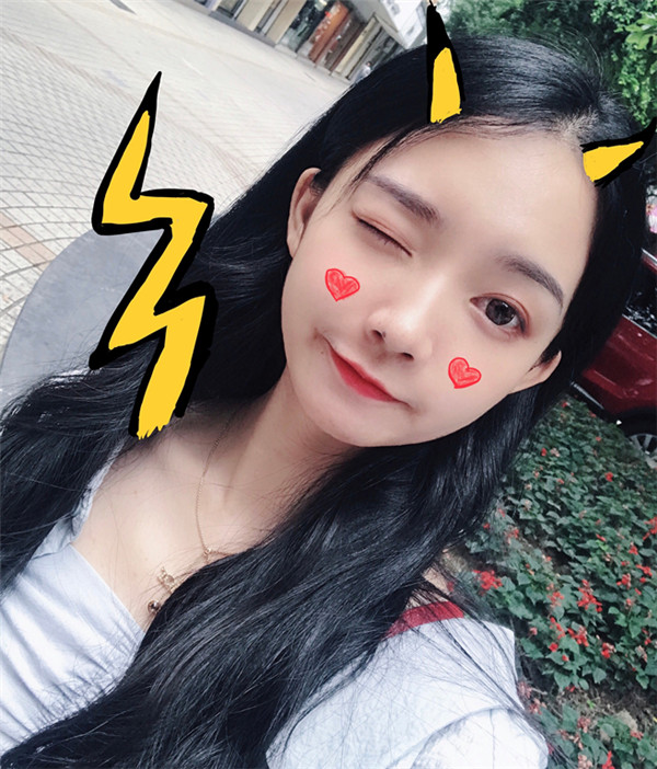 芜湖伊莱美徐世龙双眼皮怎么样?价格案例