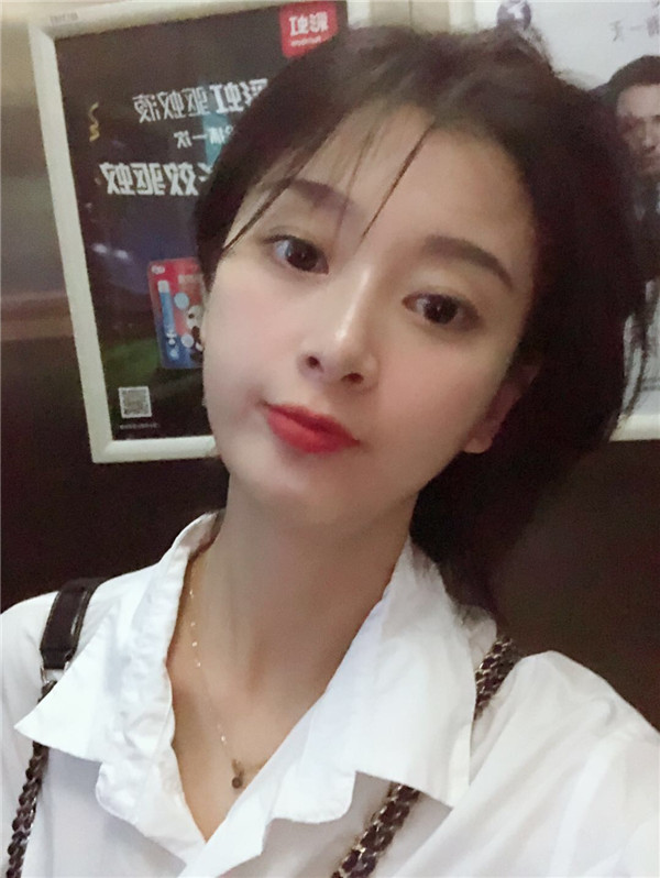 北京长虹于志宏膨体隆鼻怎么样?价格案例