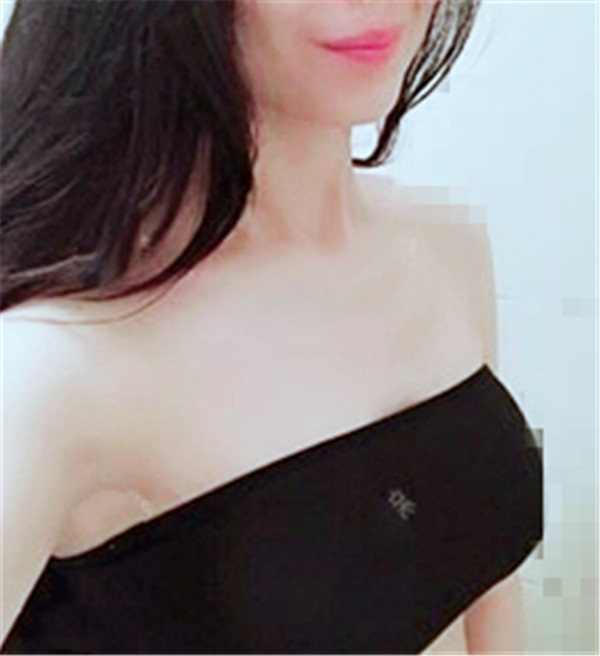 福州美莱华美黄剑媚假体隆胸怎么样?价格案例