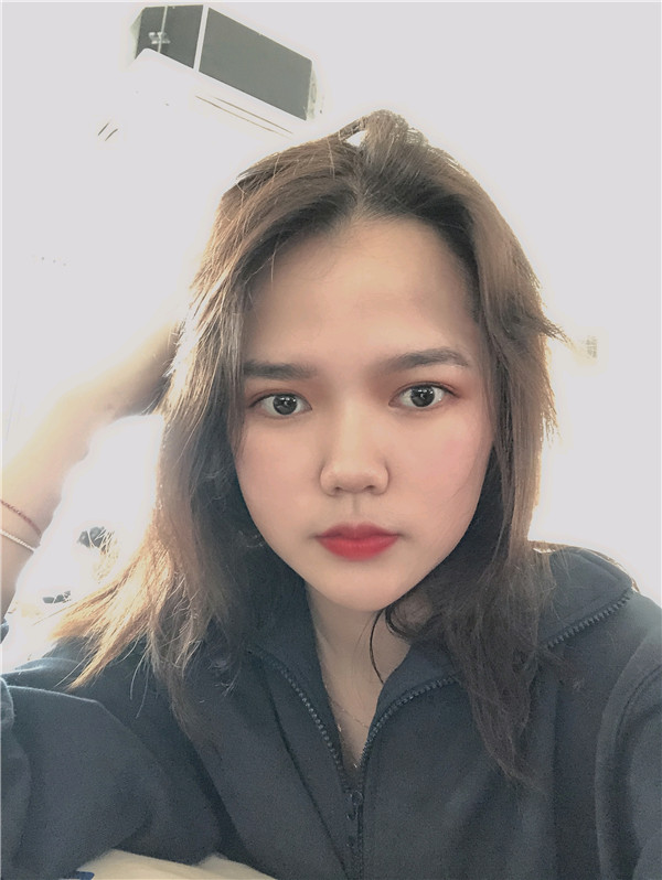 大直超龙王海刚切开双眼皮怎么样?价格案例
