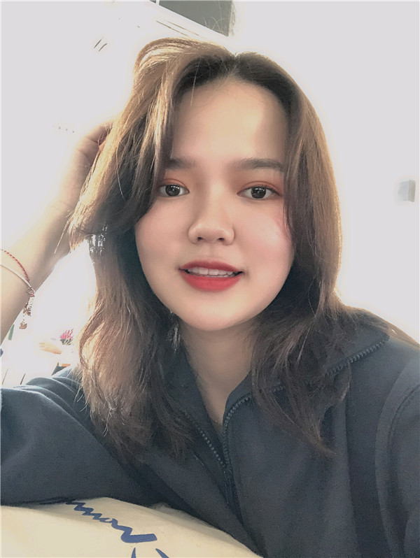 大直超龙王海刚切开双眼皮怎么样?价格案例