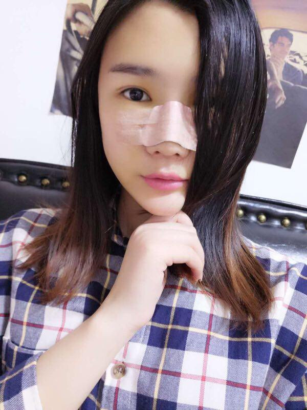 厦门安黛美林清福做鼻子怎么样?价格案例