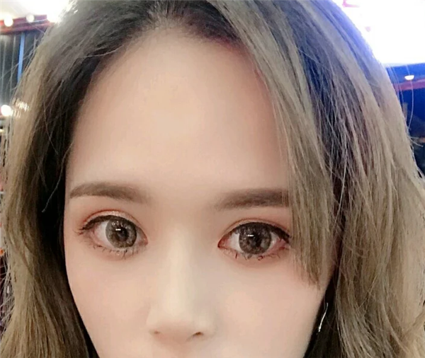 上海愉悦美联臣林军隆鼻怎么样?价格案例