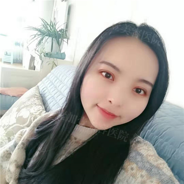合肥壹加壹甘泉涌眼部整形怎么样?价格案例