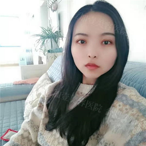 合肥壹加壹甘泉涌眼部整形怎么样?价格案例