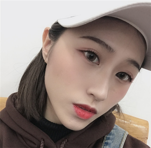 宁波童颜陈新平脂肪填充怎么样?价格案例