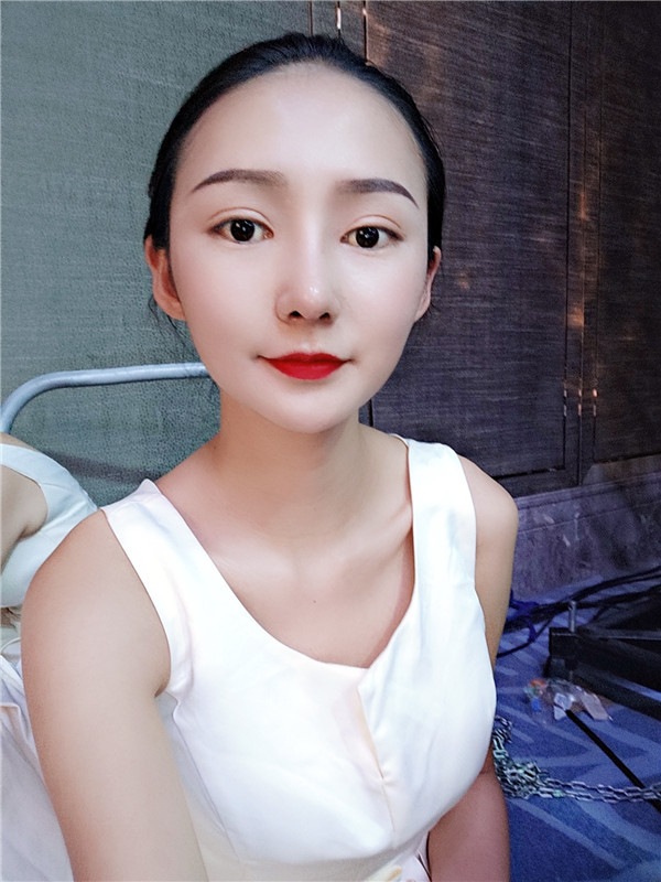 云南华美美莱李韬双眼皮怎么样?价格案例