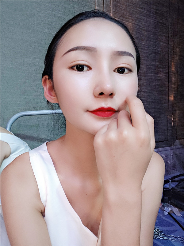 云南华美美莱李韬双眼皮怎么样?价格案例