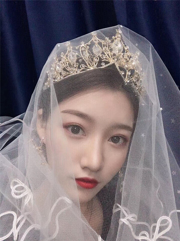 厦门安黛美林清福埋线提升怎么样?价格案例