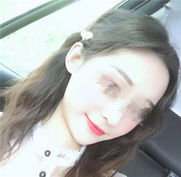 郑州辰星王保健鼻部手术怎么样?价格案例