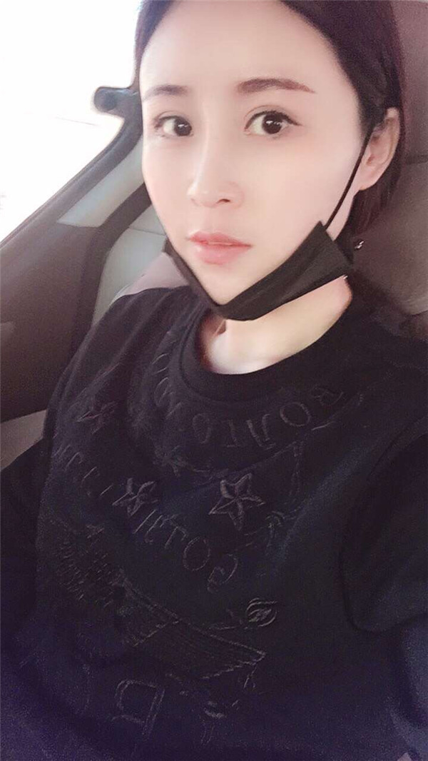 西宁时光整形王双余鼻部手术怎么样?价格案例