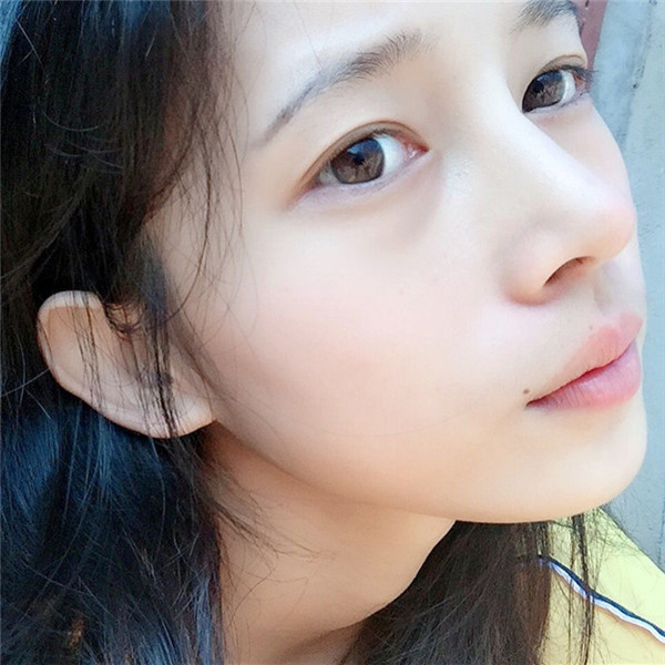 福州美贝尔杨国化隆鼻怎么样?价格案例