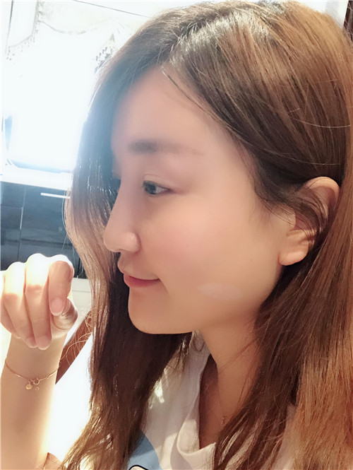 北京和颜美帕鼻部手术怎么样?好不好?案例分享