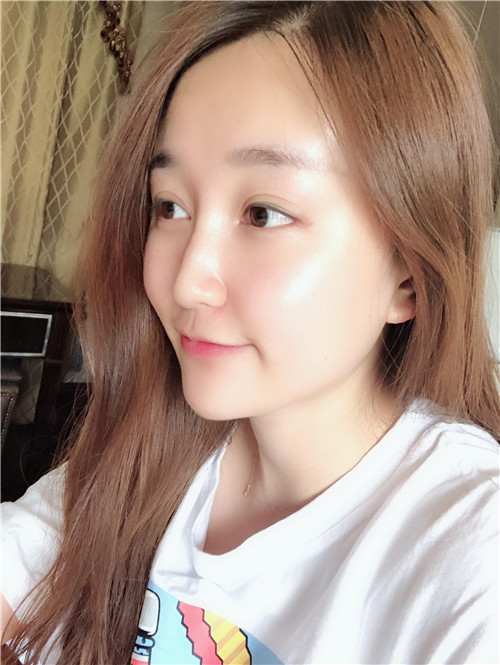 北京和颜美帕鼻部手术怎么样?好不好?案例分享