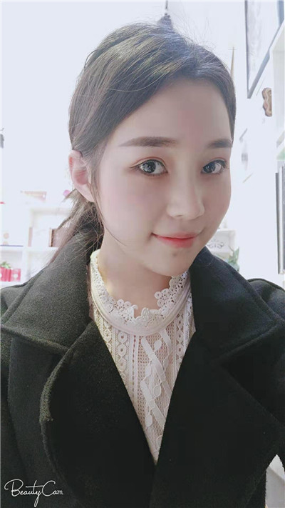 福州格莱美鼻部手术怎么样?案例分享