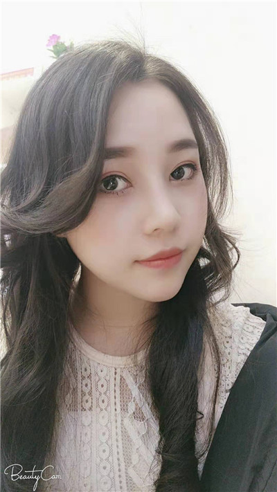 福州格莱美鼻部手术怎么样?案例分享
