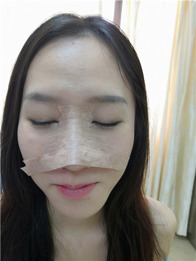 广东美恩陈宏彬怎么样?案例分享