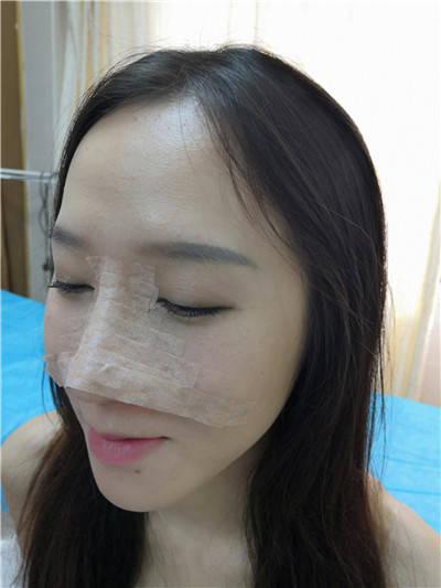 广东美恩陈宏彬怎么样?案例分享