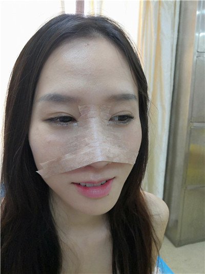 广东美恩陈宏彬怎么样?案例分享