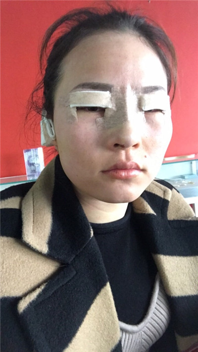 长春中妍王纳怎么样?案例分享