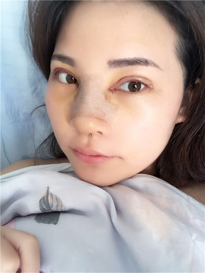 长春中妍王纳怎么样?案例分享