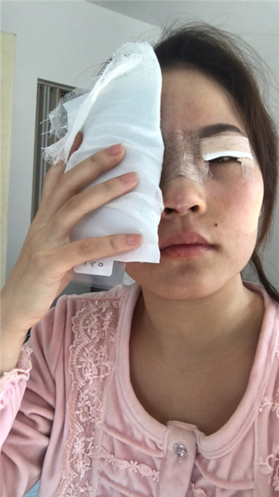 长春中妍王纳怎么样?案例分享