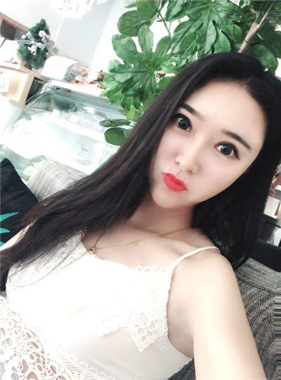 烟台华怡聂瑞锋双眼皮好不好?案例分享