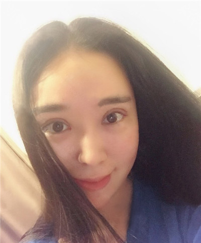 烟台华怡聂瑞锋双眼皮好不好?案例分享