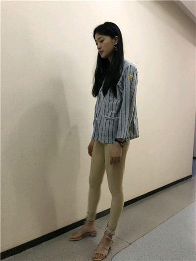 重庆瑞俪胡小义吸脂好不好?案例分享
