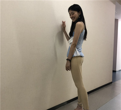 重庆瑞俪胡小义吸脂好不好?案例分享