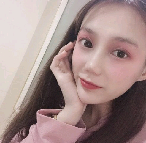 蚌埠涵韩张哲肋软骨隆鼻怎么样?好不好?案例分享