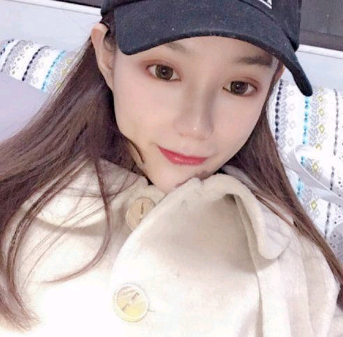 蚌埠涵韩张哲肋软骨隆鼻怎么样?好不好?案例分享